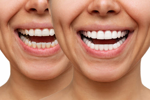 Cosmetic Dentistry in Carlisle, PA