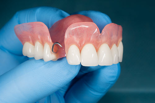 Full and Partial Dentures