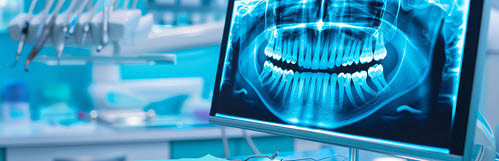 Digital Dental X-Rays