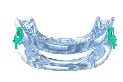 Sleep Apnea