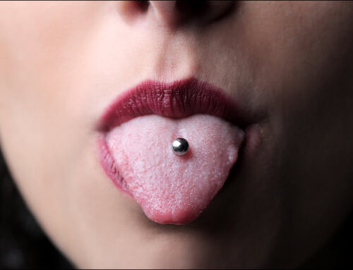 Mouth and Tongue Piercings: Dental Risks