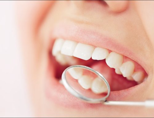 Dental Fillings: Treat Cavities and Protect Your Smile