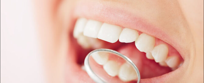 Fillings